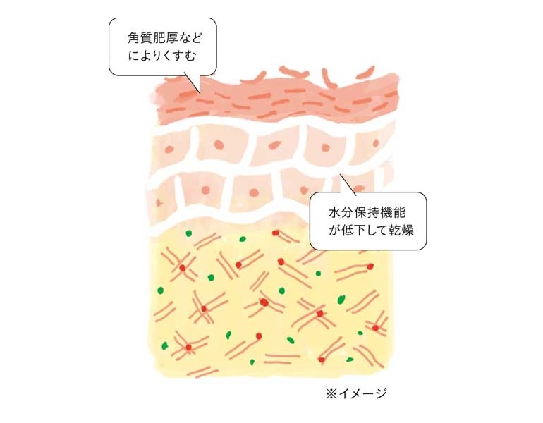 年代別の肌トラブルとその原因 年代別肌悩み ケア方法 徹底ガイド ２ 読み物 日々をここちよく 化粧品 スキンケア 基礎化粧品の通販 オルビス公式オンラインショップ